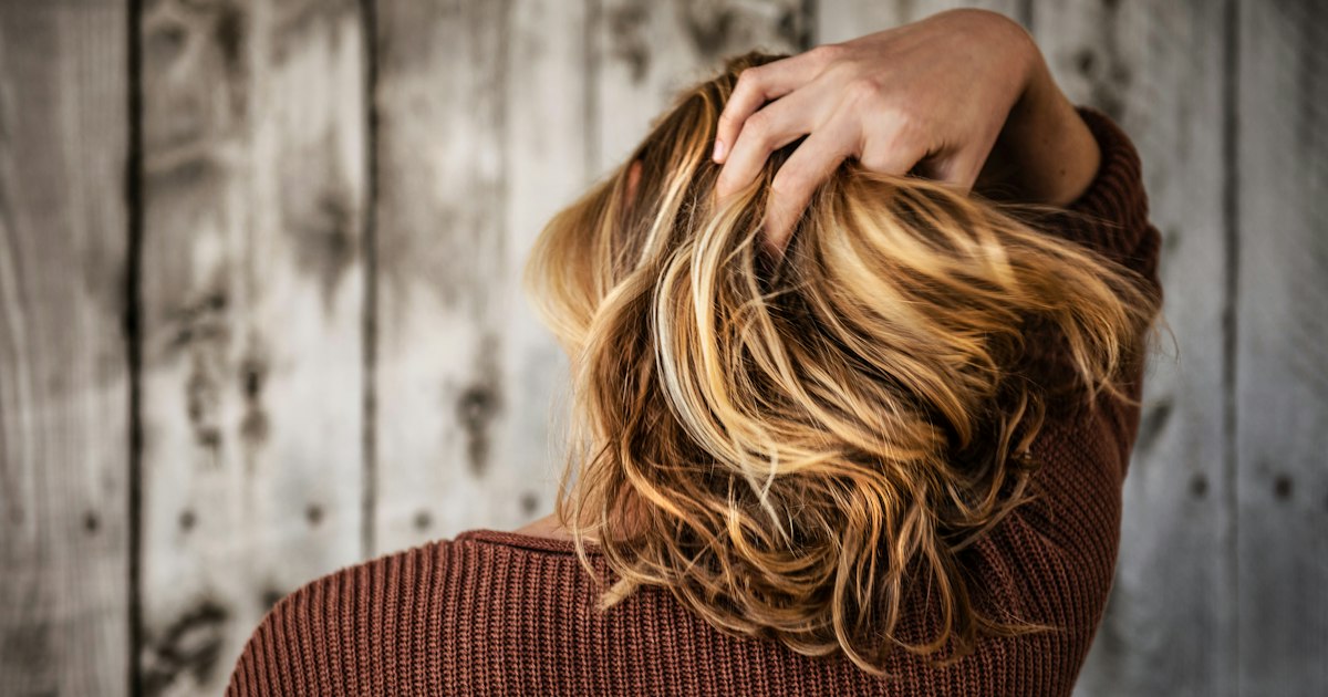 Turinabol en haar: het risico op androgene kaalheid